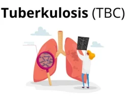 Siswa SMA/SMK di Sulbar Terancam TBC! Dinkes Gerak Cepat dengan Skrining dan Squad Anti TBC”