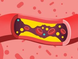 Obat Baru Potong Kolesterol Remnant 61 Persen dalam Uji Coba