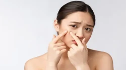 Viral Cairan Infus untuk Wajah, Dokter Tegaskan NaCl Tak Terbukti Hilangkan Jerawat