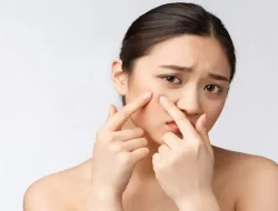 Viral Cairan Infus untuk Wajah, Dokter Tegaskan NaCl Tak Terbukti Hilangkan Jerawat